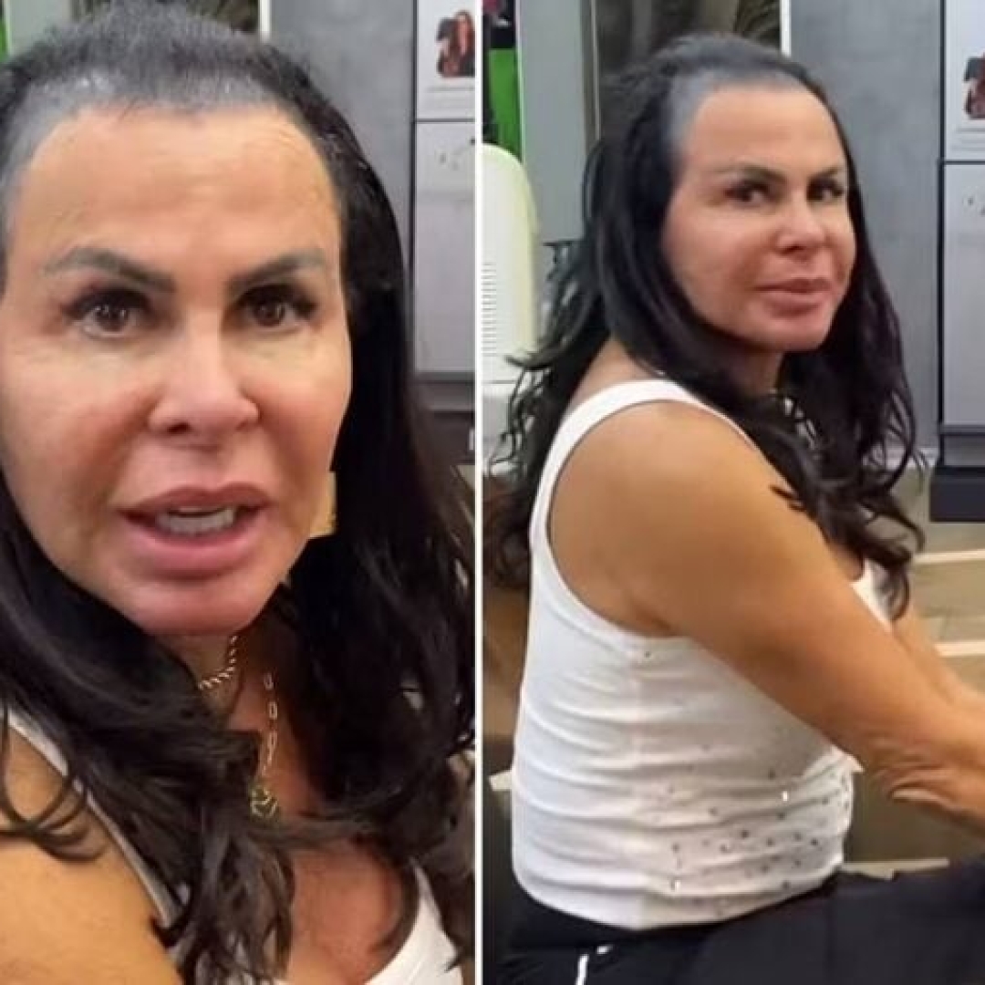 Gretchen mostra calvície antes de mega hair